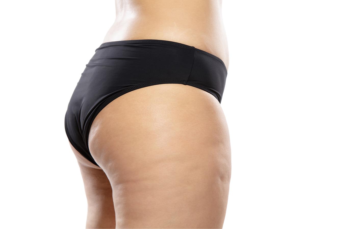 Close-up of cellulite on a woman's thighs